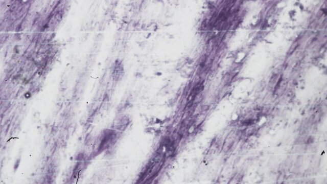 Abstract bacteria and microbes under the microscope. Fungus or mold is investigated in a scientific laboratory. Veterinary clinic, animal diseases. Microorganism cells