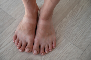 Close-up of tanned female legs with white stripes on the skin from sandals.