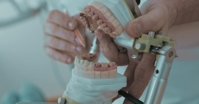 Close-up the dental articulator and inside of it is the ceramic model of a human jaw with pink and white teeth which is holding in the hand's male medical worker.