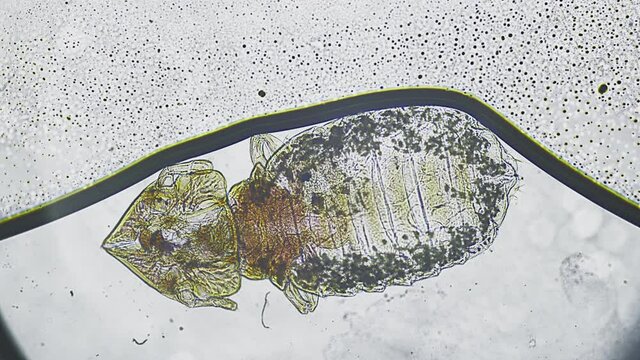 Head lice under the microscope. Skin flea under magnification. Animal disease in the veterinary laboratory. The insect in the hair of the body drinks the blood. Beetles in animals. Transparent cell.
