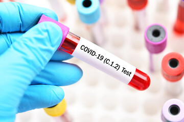 Test tube with blood sample for COVID-19 C.1.2 variant test, new variant epidemic in South Africa