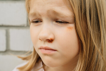 Portrait girl with an abrasion under her eye. child abuse. wounds and abrasions