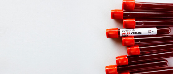 Many tubes of blood test with the label Covid-19 Delta Variant Test