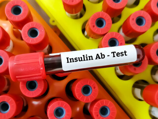 Blood sample for Insulin Antibody testing. marker for type 1 diabetes.