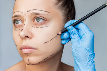 Cropped shot of a young caucasian woman with marking on her face on a gray background. The doctor's gloved hand makes marks on the patient's face. Facial plastic surgery concept