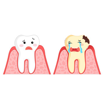 the character of healthy teeth and cavities