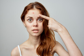 woman with a pimple on the face cosmetology Studio