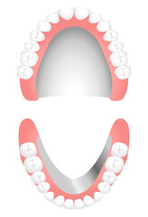 入れ歯（金属床）