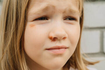 Portrait girl with an abrasion under her eye. child abuse. wounds and abrasions