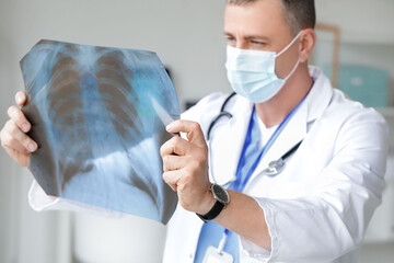 Mature doctor studying x-ray image of lungs in clinic