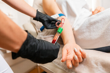 Cosmetologist makes blood sampling from the client's hand for the plasmolifting procedure. Professional rejuvenation procedure in salon. Close up