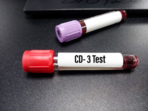 Blood sample for CD3(cluster of differentiation 3) test, T-cell receptor