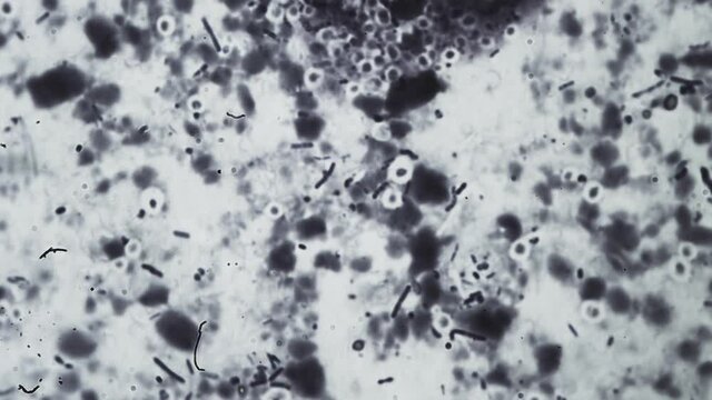 Abstract bacteria and microbes under the microscope. Fungus or mold is investigated in a scientific laboratory. Veterinary clinic, animal diseases. Microorganism cells