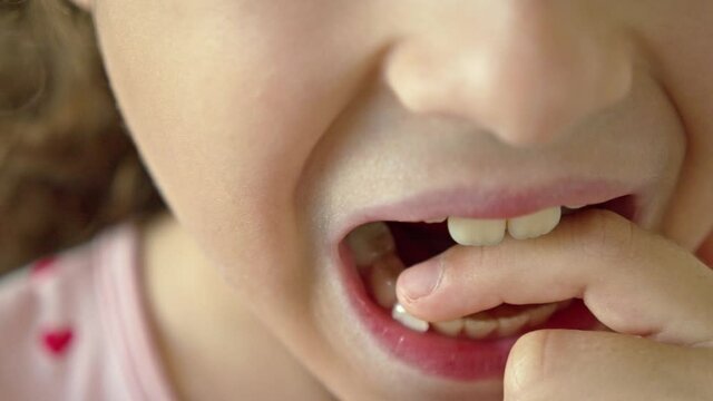 Portrait of a child with a smile on his face loosens his milk tooth. Cute little girl of 8-9 years old is losing milk teeth. Loss of deciduous teeth,replacement of permanent teeth. Children's
