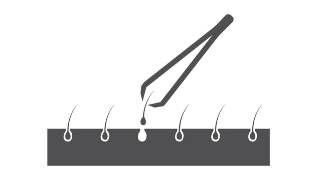 Illustration of tweezers and hair on the skin. Vector isolated editable flat illustration