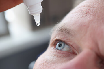 Young caucasian man shot in head with eye drops