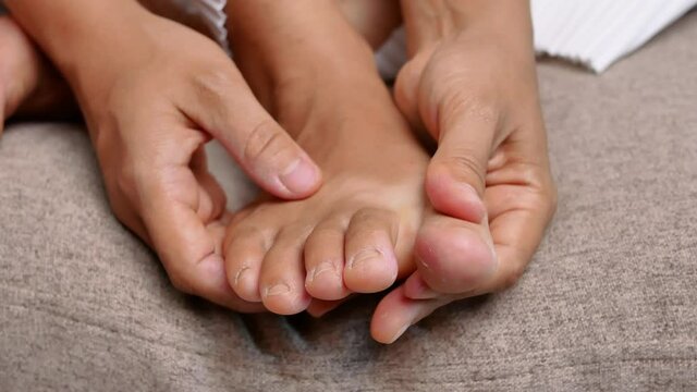 Closeup of female holding her painful feet and massaging her bunion toes to relieve pain. Swollen bunion at the edge of the big toe causes deformity (Hallux valgus). Woman's health concept.