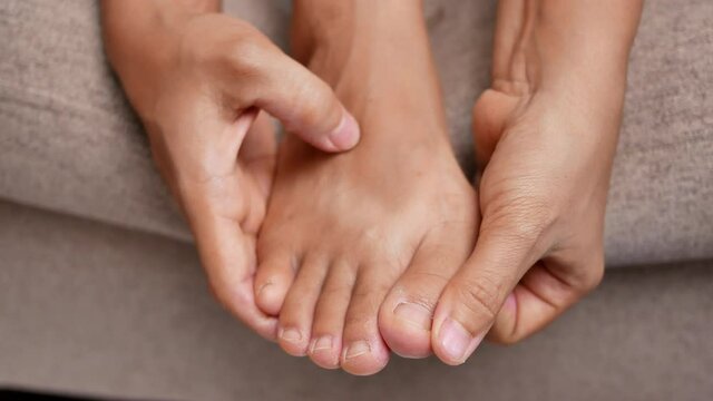 Closeup of female holding her painful feet and massaging her bunion toes to relieve pain. Swollen bunion at the edge of the big toe causes deformity (Hallux valgus). Woman's health concept.