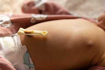 Newborn baby girl laying down with umbilical cord still attached - close up on belly
