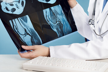 Female doctors hand pointing at x-ray or MRI medical imaging with a knee condition. Joint and...