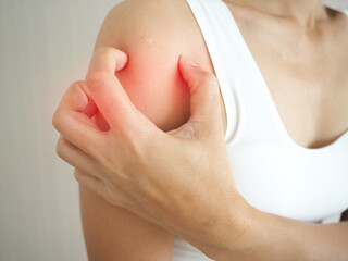 A woman with itching scratching her shoulder skin caused by eczema, allergic skin, dermatitis and insect bites. closeup photo, blurred.