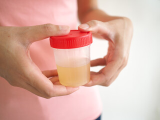 Woman holding a bottle of urine in hand to take a pregnancy test on white background. closeup photo, blurred.