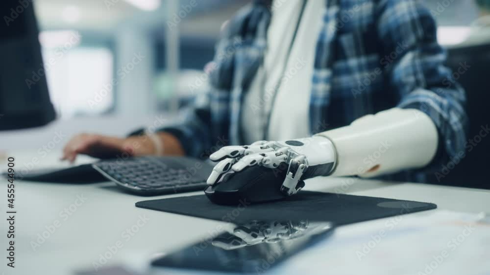 Poster Inclusive Office: Person with Disability Using Prosthetic Arm to Work on Computer. Professional with Advanced Thought Controlled Body Powered Myoelectric Bionic Limb to Control Mouse. Focus on Hands