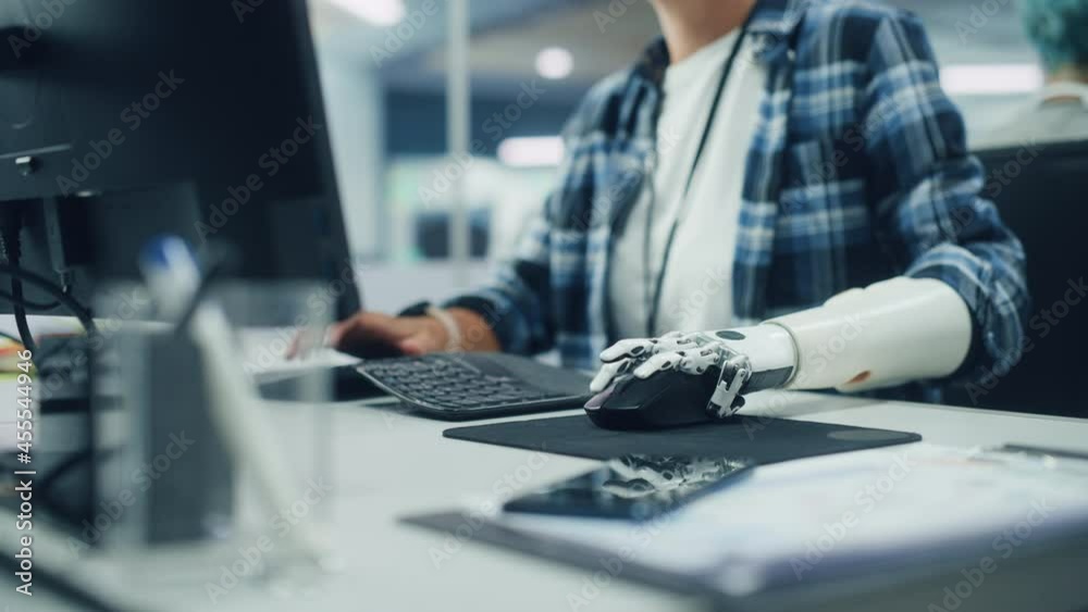 Poster Diverse Office: Person with Disability Using Prosthetic Arm to Work on Computer. Professional with Advanced Thought Controlled Body Powered Myoelectric Bionic Limb to Control Mouse. Focus on Hands