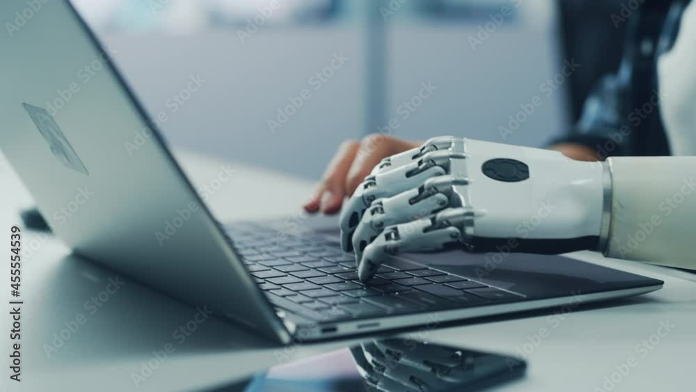 Poster Close-up on Hands: Person with Disability Using Prosthetic Arm to Work on Laptop Computer. Specialist Swift and Natural Use of Thought Controlled Body Powered Myoelectric Bionic Hand. Side View