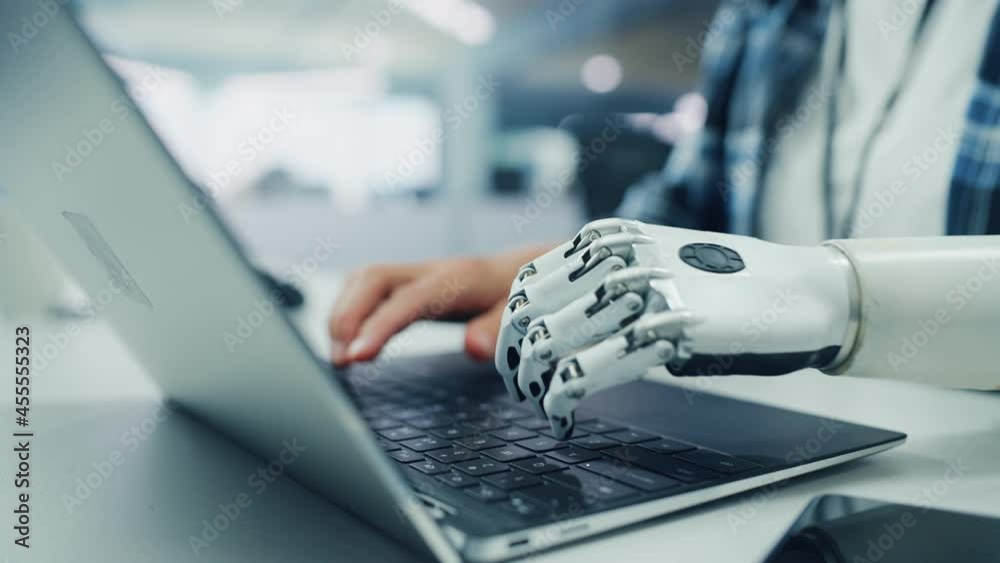 Aufkleber Close-up on Hands: Programmer With Disability Using Prosthetic Arm to Work on Laptop Computer. Specialist Swift and Natural Use of Myoelectric Bionic Hand To Type Code for Software