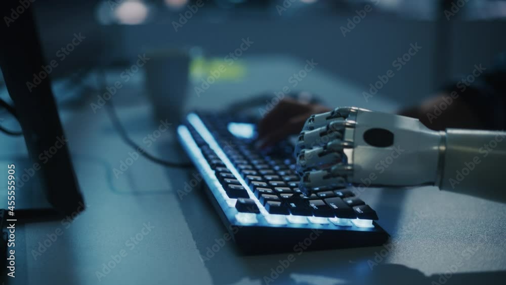 Leinwandbilder Close-up on Hands: Programmer With Disability Using Prosthetic Arm to Work on Computer Keyboard. Specialist Swift and Natural Use of Myoelectric Bionic Hand To Type for e-Commerce Software Project
