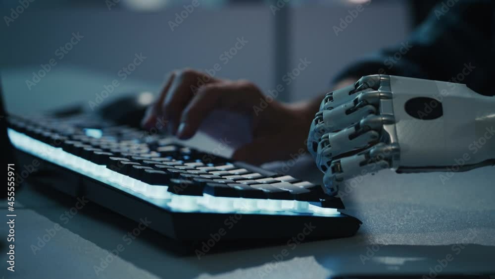 Poster Close-up on Hands: Programmer With Disability Using Prosthetic Arm to Work on Computer Keyboard. Specialist Swift and Natural Use of Myoelectric Bionic Hand To Type for e-Commerce Software Project