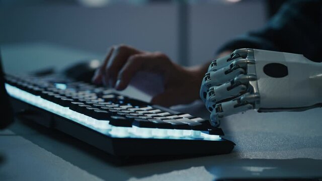 Close-up on Hands: Programmer With Disability Using Prosthetic Arm to Work on Computer Keyboard. Specialist Swift and Natural Use of Myoelectric Bionic Hand To Type for e-Commerce Software Project
