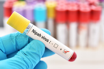 Fototapeta premium Blood sample tube positive with Nipah virus test