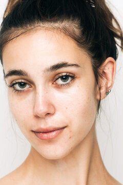 Portrait Of Woman With Real Skin Imperfections