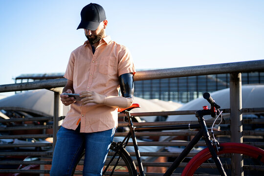 Man with Arm Prosthesis Using Phone