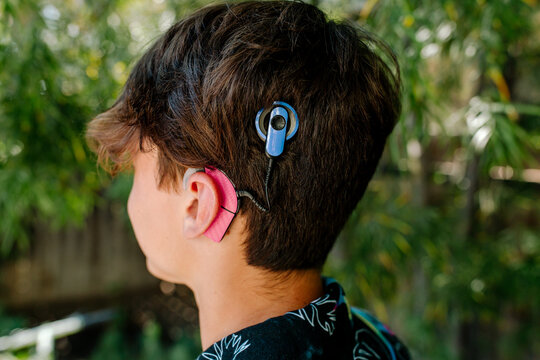 Close up of Nucleus Cochlear implant