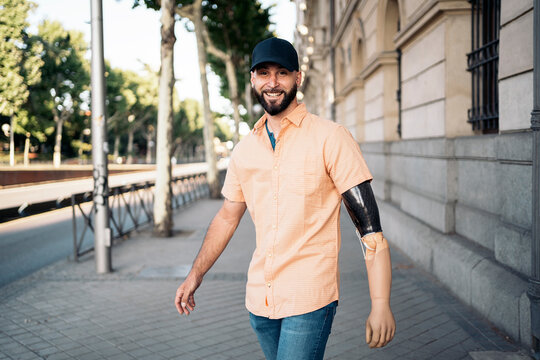 Happy Man with Arm Prosthesis