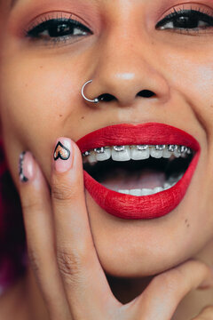 Portrait of a smiling woman with braces