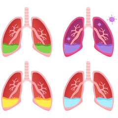 Vector illustration set of a sick lung, suitable for advertising health and education products