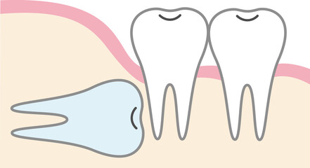 親知らずのイラスト