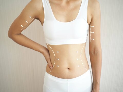 Young woman torso in underwear with the drawing arrows and medical marks. fat lose, liposuction, cellulite removal and skin lifting concept. closeup photo, blurred.
