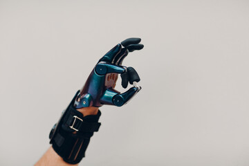 Young disabled man showing okay ok gesture with artificial prosthetic hand