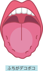 舌の健康についてのイラスト