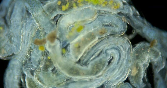 Worms Aeolosoma sp. under a microscope, Aeolosomatidae family. They live on bottom or bottom sediments, feed on detritus, algae, microorganisms by suction like a vacuum cleaner.