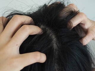 Asian woman scratching on head from itching. closeup photo, blurred.