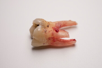 Close up of a tooth with a bit of blood stain on a white background.