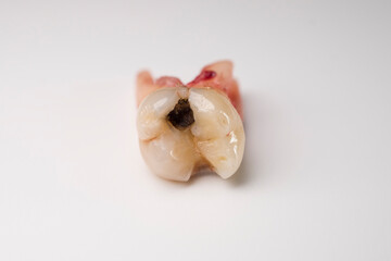 Close up of a tooth with a bit of blood stain on a white background.