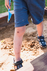 A child in a sandpit with a broken knee - wound, bruises and abrasions as a result of playing