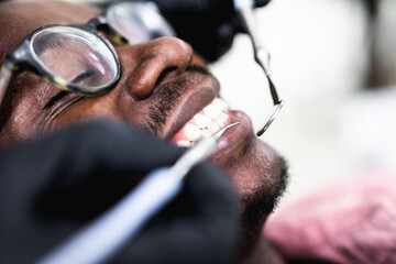 African American man having dental treatment at dentist's office.
